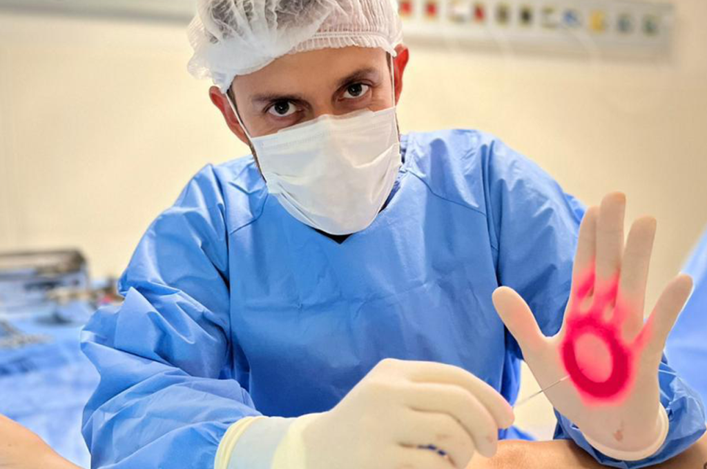 Um profissional da área médica usando jaleco azul, rede de cabelo e máscara segura uma mão enluvada com uma marca circular vermelha na palma, enquanto usa um instrumento médico endolaser na outra mão.